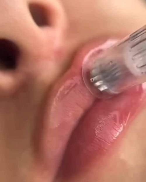 HIDRATACIÓN LABIAL 1 SESION